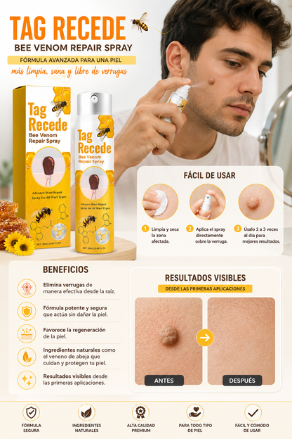 Tag Recede Elimina verrugas Dropi cup